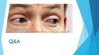 Q&A
 