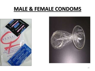 Condme PowerPoint presentation on Modern Contraceptives | PPTX