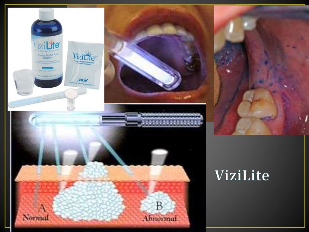 Modern dental and diagnostic tools