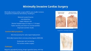 Modern Innovations in Cardiac Surgery.pptx