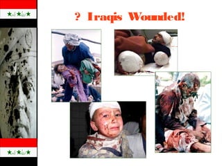 ? Iraqis Wounded!
 