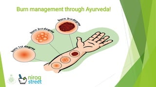 Burn management through Ayurveda!
 