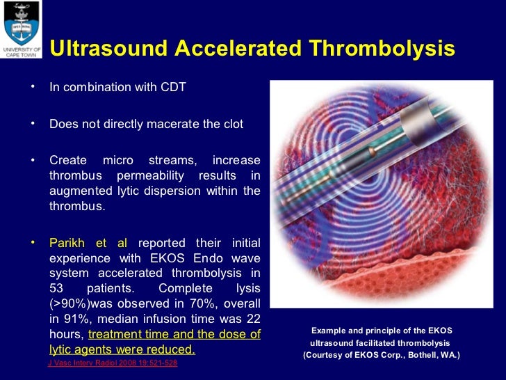 deep vein thrombosisdr sharfuddin chowdhury 45 728