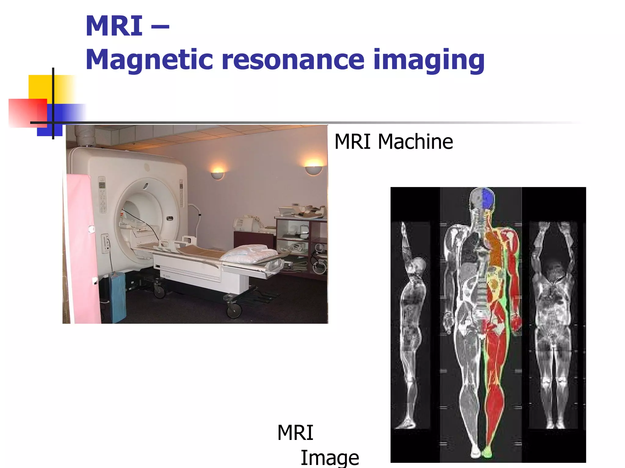 MRI –  Magnetic resonance imaging MRI Image MRI Machine 