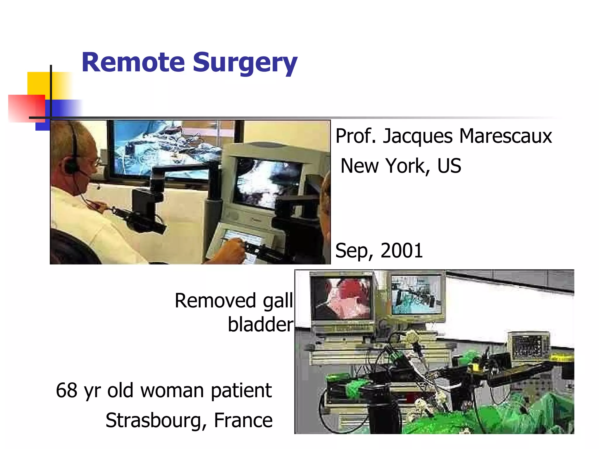 Remote Surgery New York, US Strasbourg, France Sep, 2001 Prof. Jacques Marescaux  68 yr old woman patient Removed gall bladder 