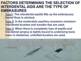 FACTORS DETERMINING THE SELECTION OF
INTERDENTAL AIDS ARE THE TYPE OF
EMBRASURES






 