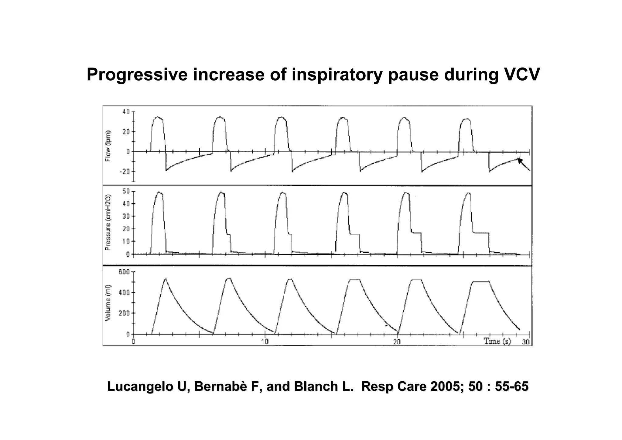 Progressive increase of inspiratory pause during VCV

Lucangelo U, Bernabè F, and Blanch L. Resp Care 2005; 50 : 55-65

 