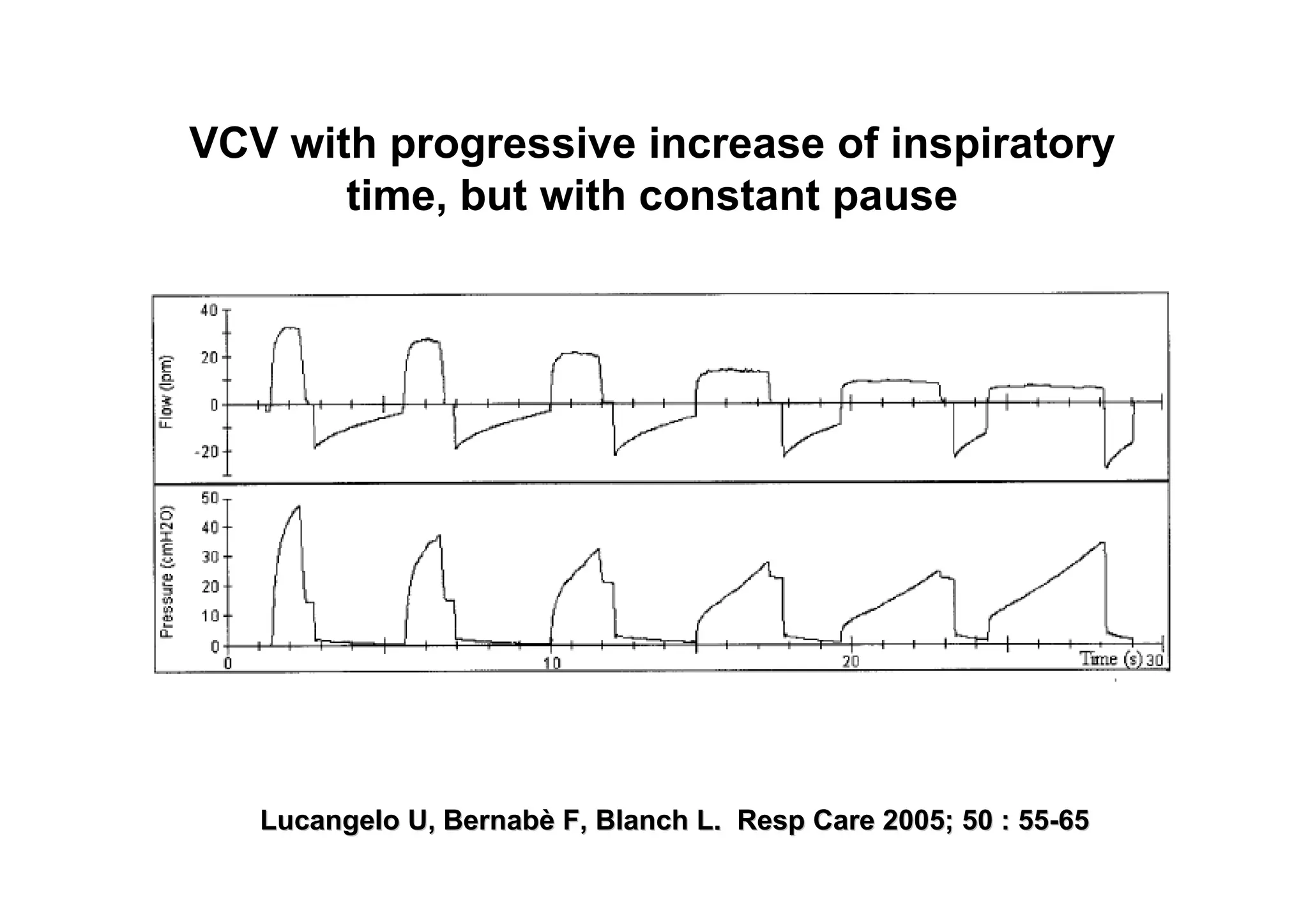 VCV with progressive increase of inspiratory
time, but with constant pause

Lucangelo U, Bernabè F, Blanch L. Resp Care 2005; 50 : 55-65

 