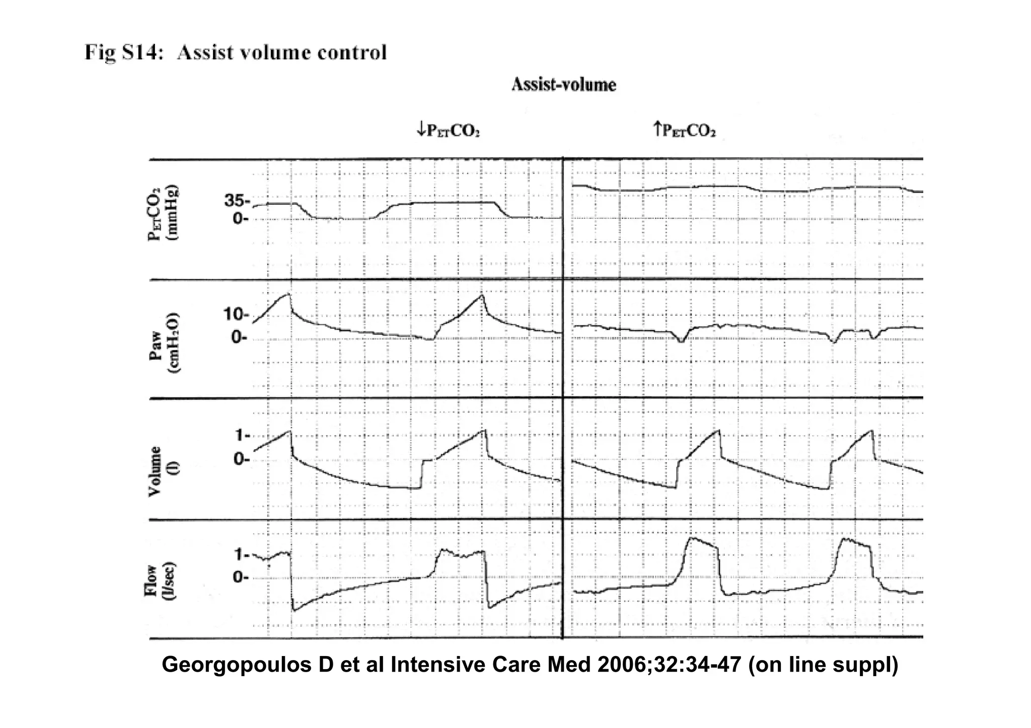 Georgopoulos D et al Intensive Care Med 2006;32:34-47 (on line suppl)

 