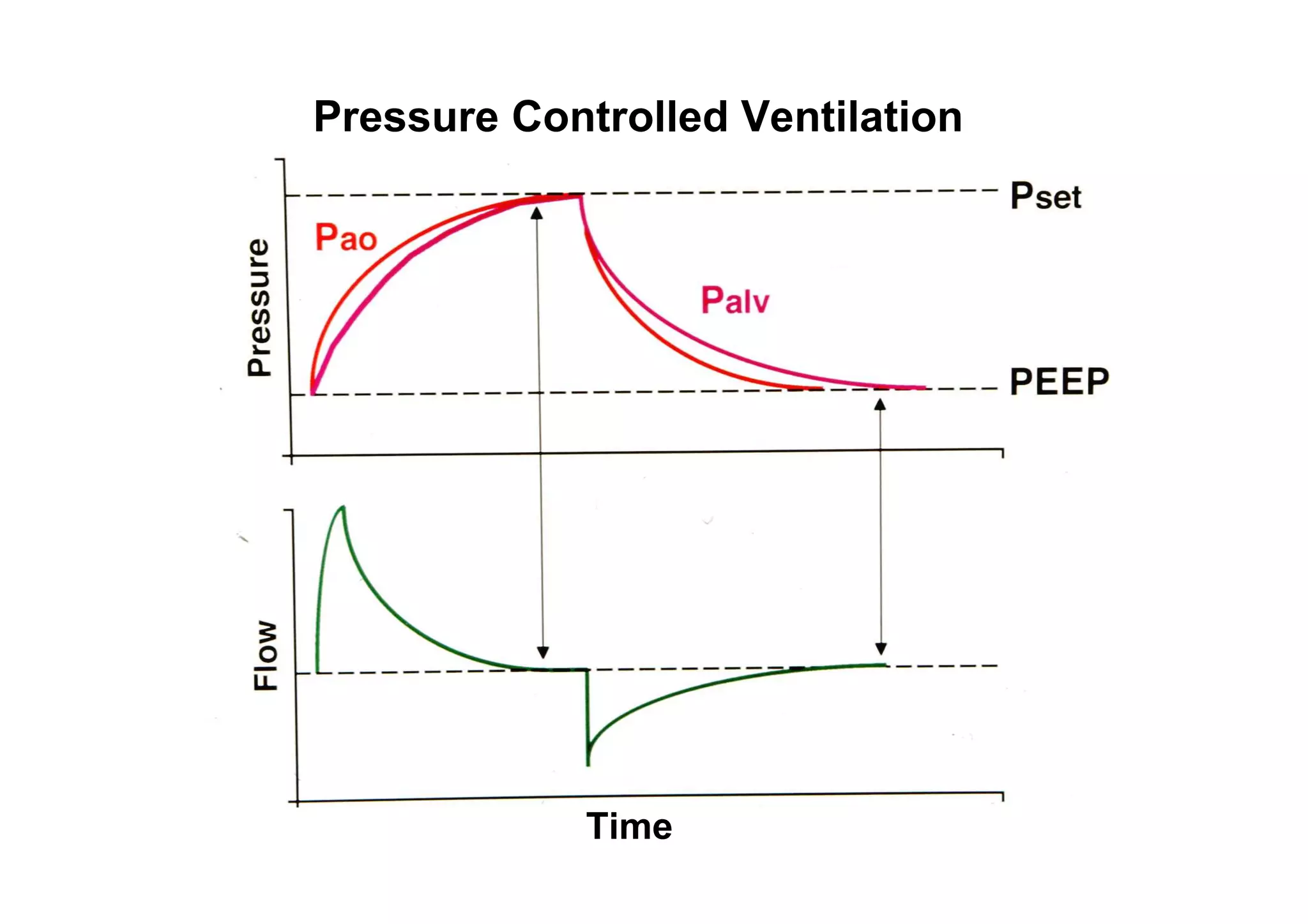Pressure Controlled Ventilation

Time

 