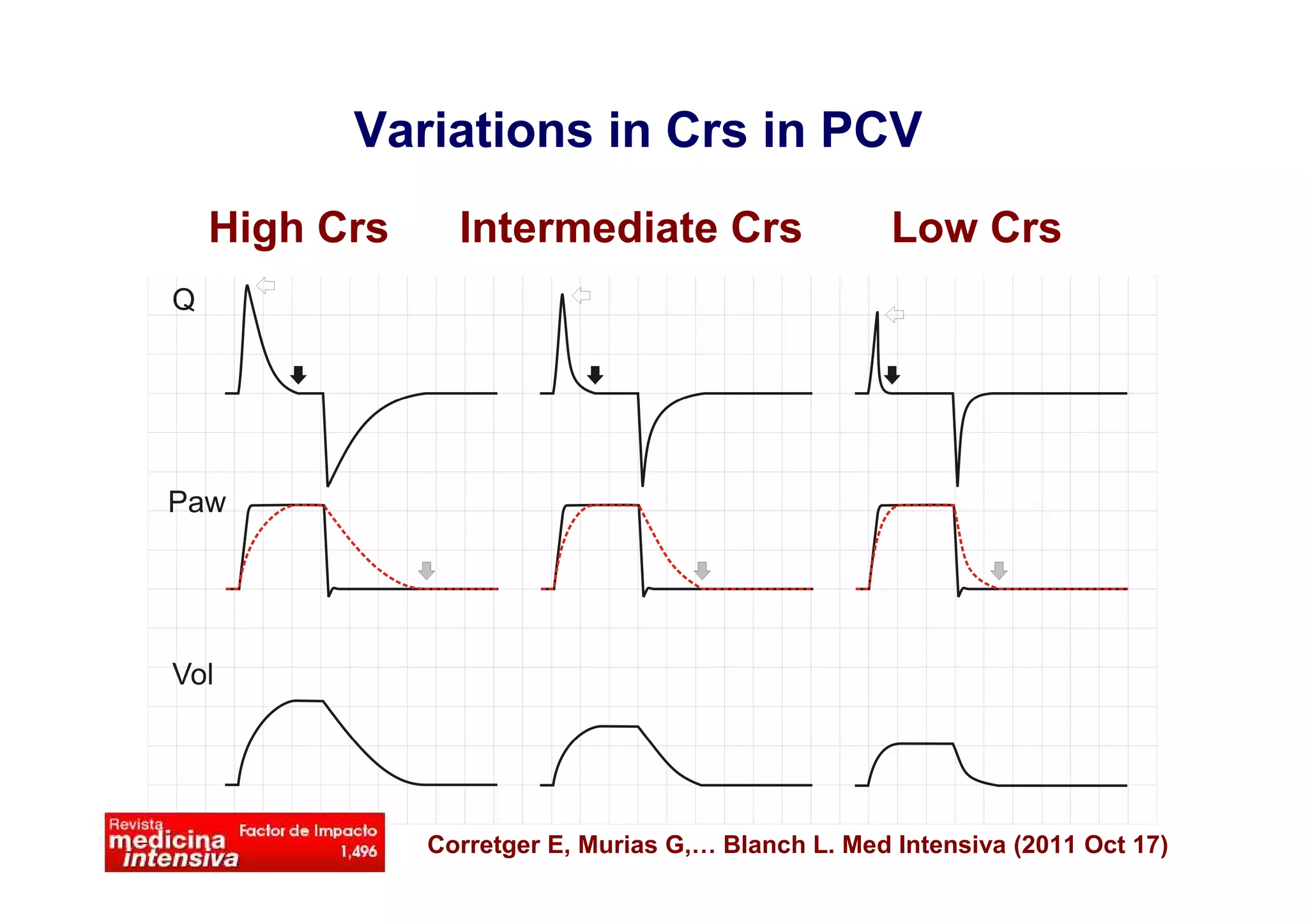 Variations in Crs in PCV
High Crs

Intermediate Crs

Low Crs

Corretger E, Murias G,… Blanch L. Med Intensiva (2011 Oct 17)

 