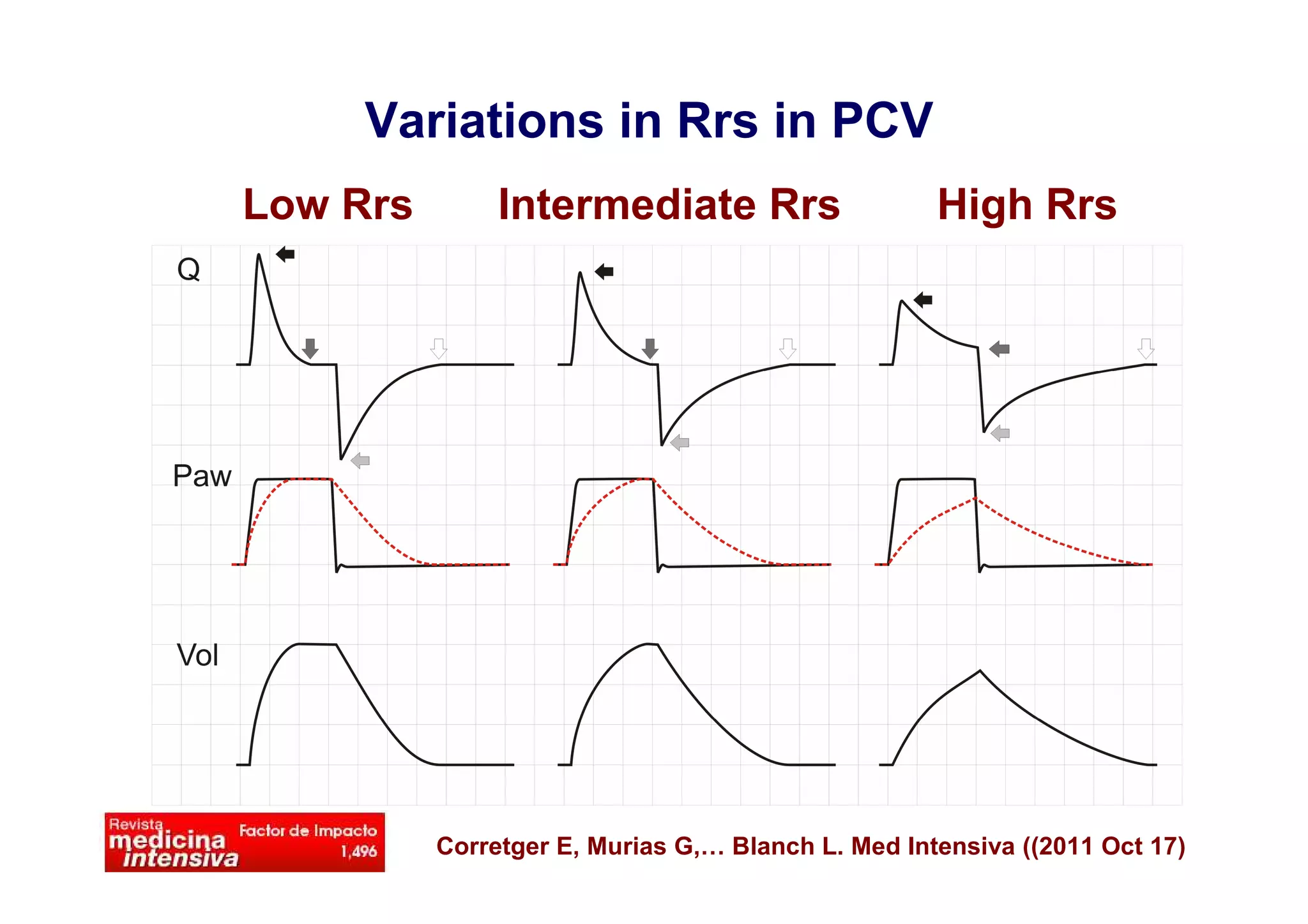 Variations in Rrs in PCV
Low Rrs

Intermediate Rrs

High Rrs

Corretger E, Murias G,… Blanch L. Med Intensiva ((2011 Oct 17)

 