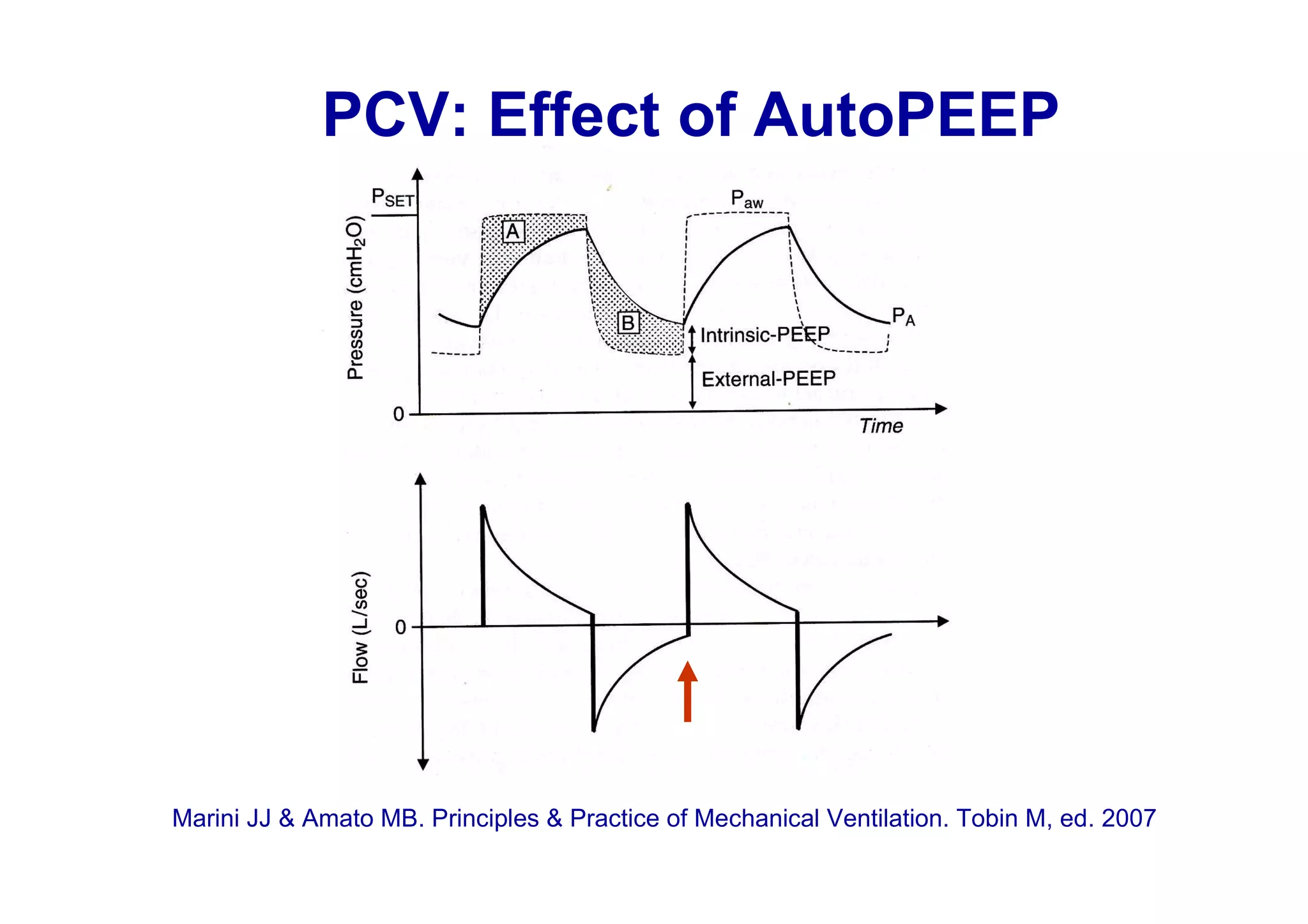 PCV: Effect of AutoPEEP

Marini JJ & Amato MB. Principles & Practice of Mechanical Ventilation. Tobin M, ed. 2007

 