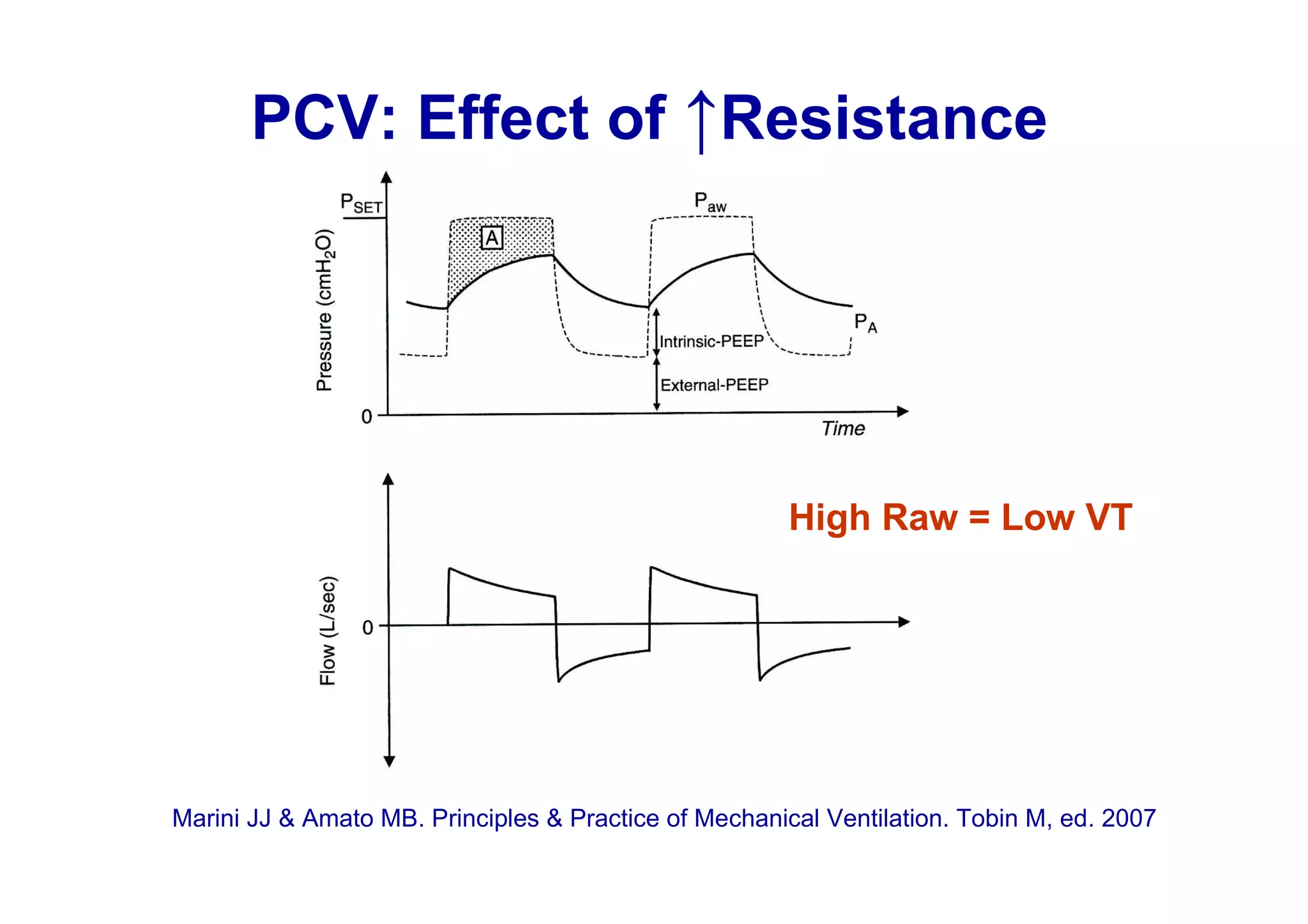 PCV: Effect of ↑Resistance

High Raw = Low VT

Marini JJ & Amato MB. Principles & Practice of Mechanical Ventilation. Tobin M, ed. 2007

 