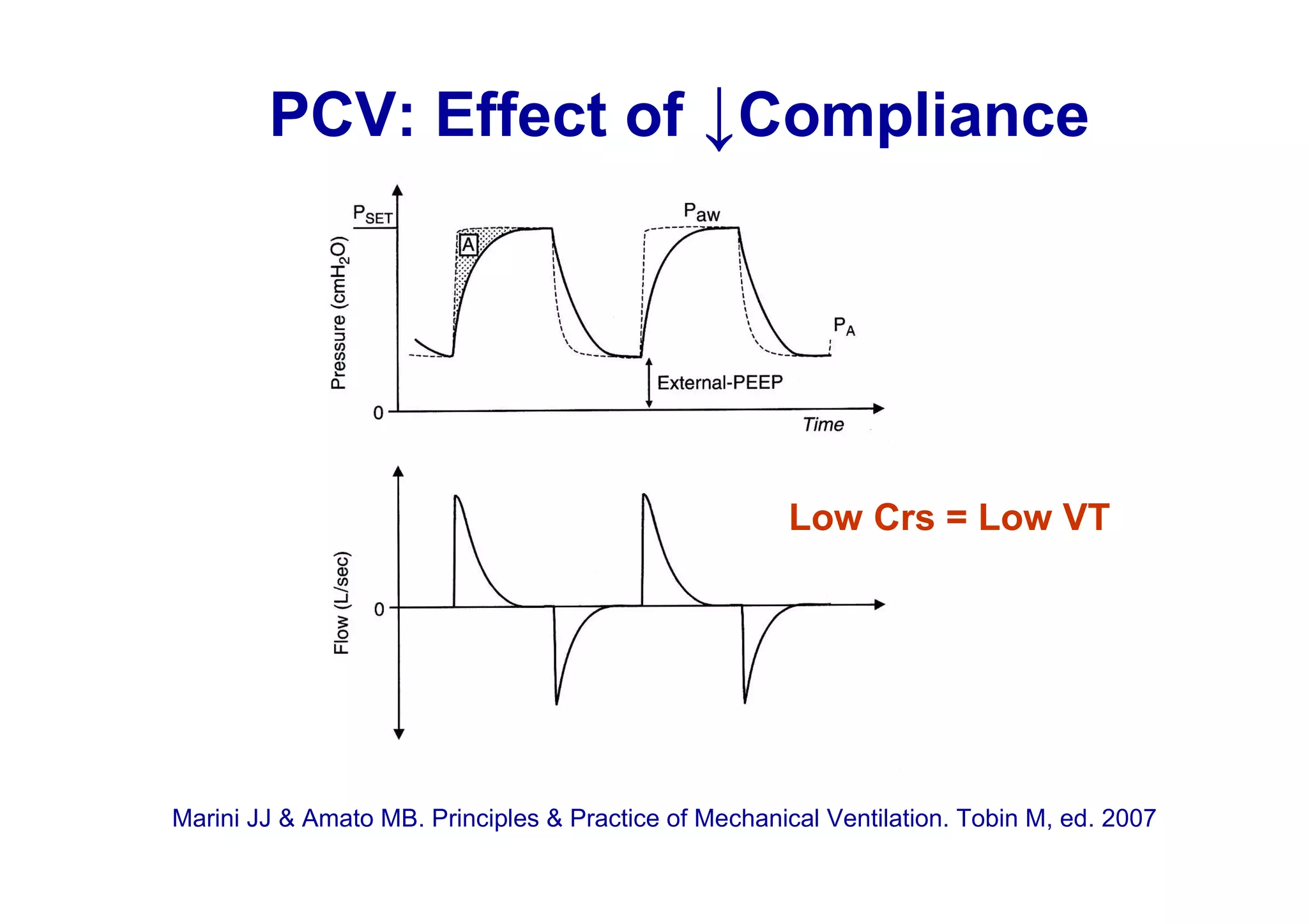 PCV: Effect of ↓Compliance

Low Crs = Low VT

Marini JJ & Amato MB. Principles & Practice of Mechanical Ventilation. Tobin M, ed. 2007

 