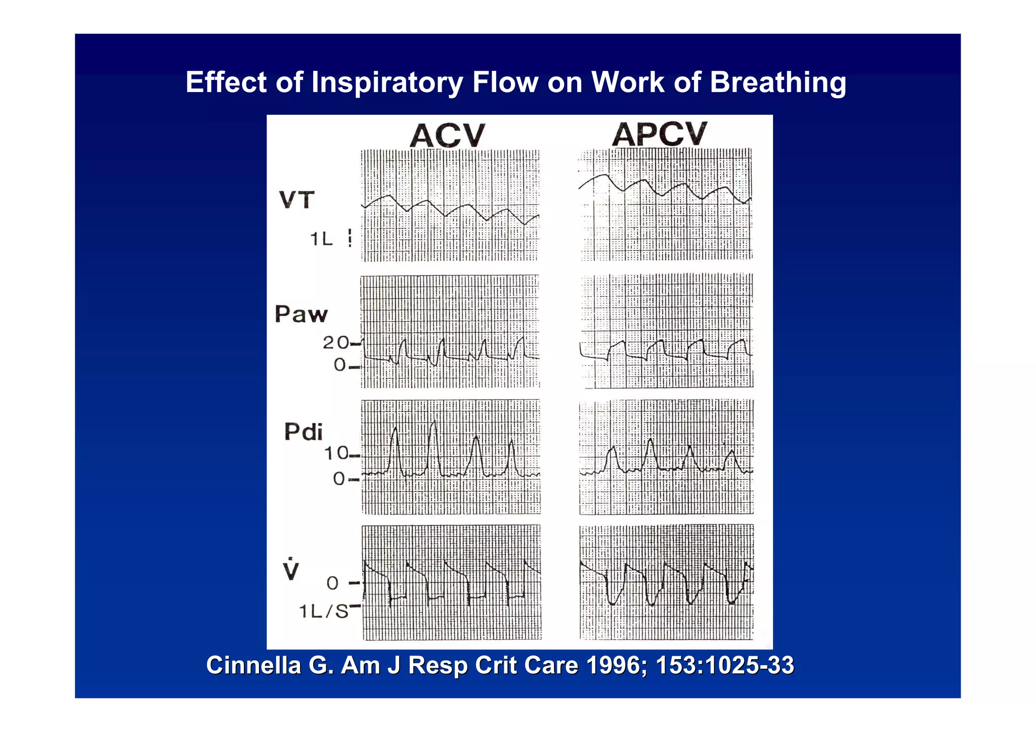 Effect of Inspiratory Flow on Work of Breathing

Cinnella G. Am J Resp Crit Care 1996; 153:1025-33

 