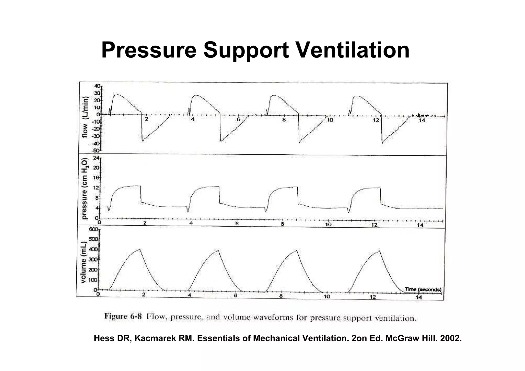 Pressure Support Ventilation

Hess DR, Kacmarek RM. Essentials of Mechanical Ventilation. 2on Ed. McGraw Hill. 2002.

 
