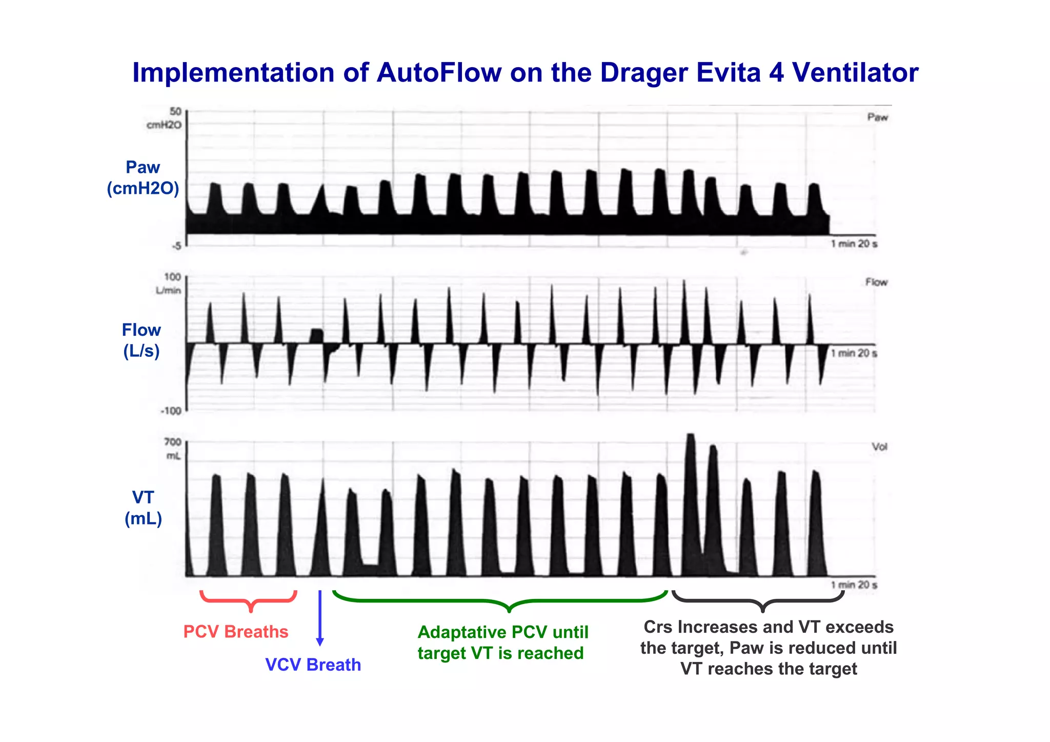 Implementation of AutoFlow on the Drager Evita 4 Ventilator

Paw
(cmH2O)

Flow
(L/s)

VT
(mL)

PCV Breaths
VCV Breath

Adaptative PCV until
target VT is reached

Crs Increases and VT exceeds
the target, Paw is reduced until
VT reaches the target

 