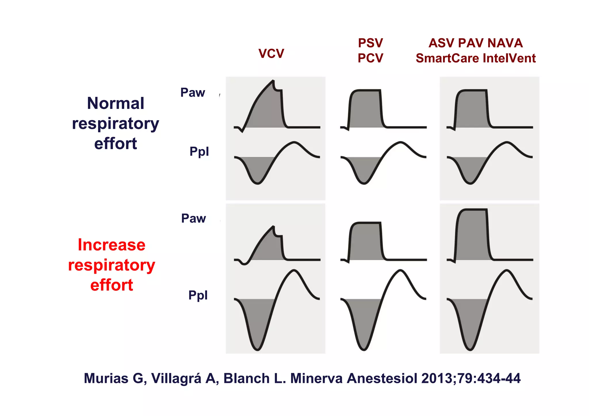 VCV

Normal
respiratory
effort

PSV
PCV

ASV PAV NAVA
SmartCare IntelVent

Paw

Ppl

Paw

Increase
respiratory
effort

Ppl

Murias G, Villagrá A, Blanch L. Minerva Anestesiol 2013;79:434-44

 