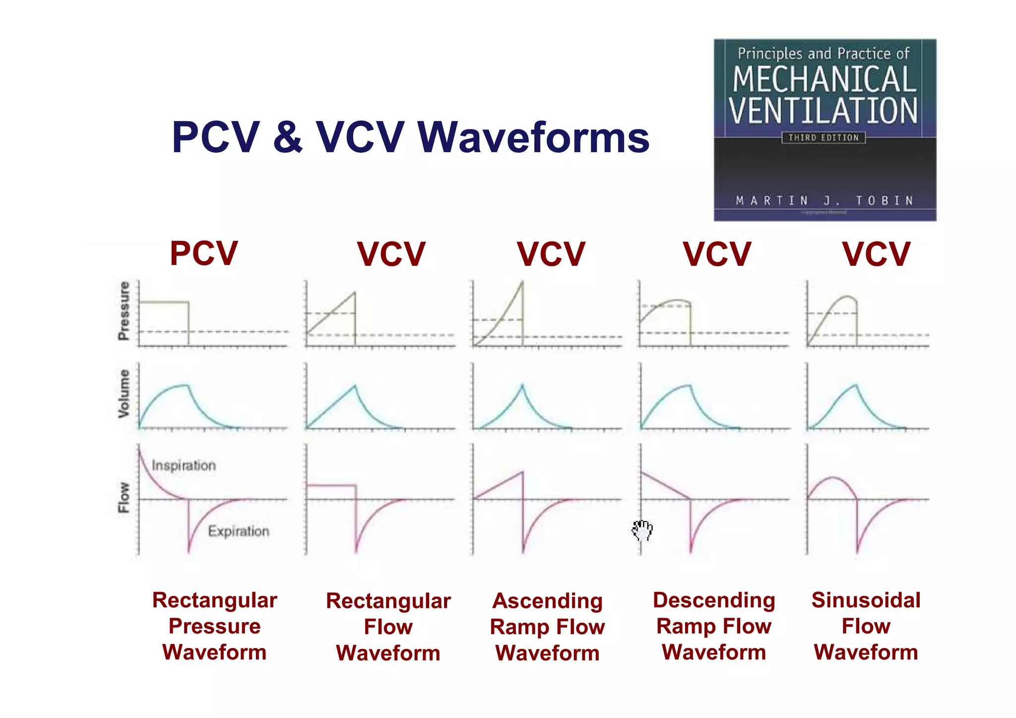 PCV & VCV Waveforms
PCV

Rectangular
Pressure
Waveform

VCV

VCV

VCV

Rectangular
Flow
Waveform

Ascending
Ramp Flow
Waveform

Descending
Ramp Flow
Waveform

VCV

Sinusoidal
Flow
Waveform

 