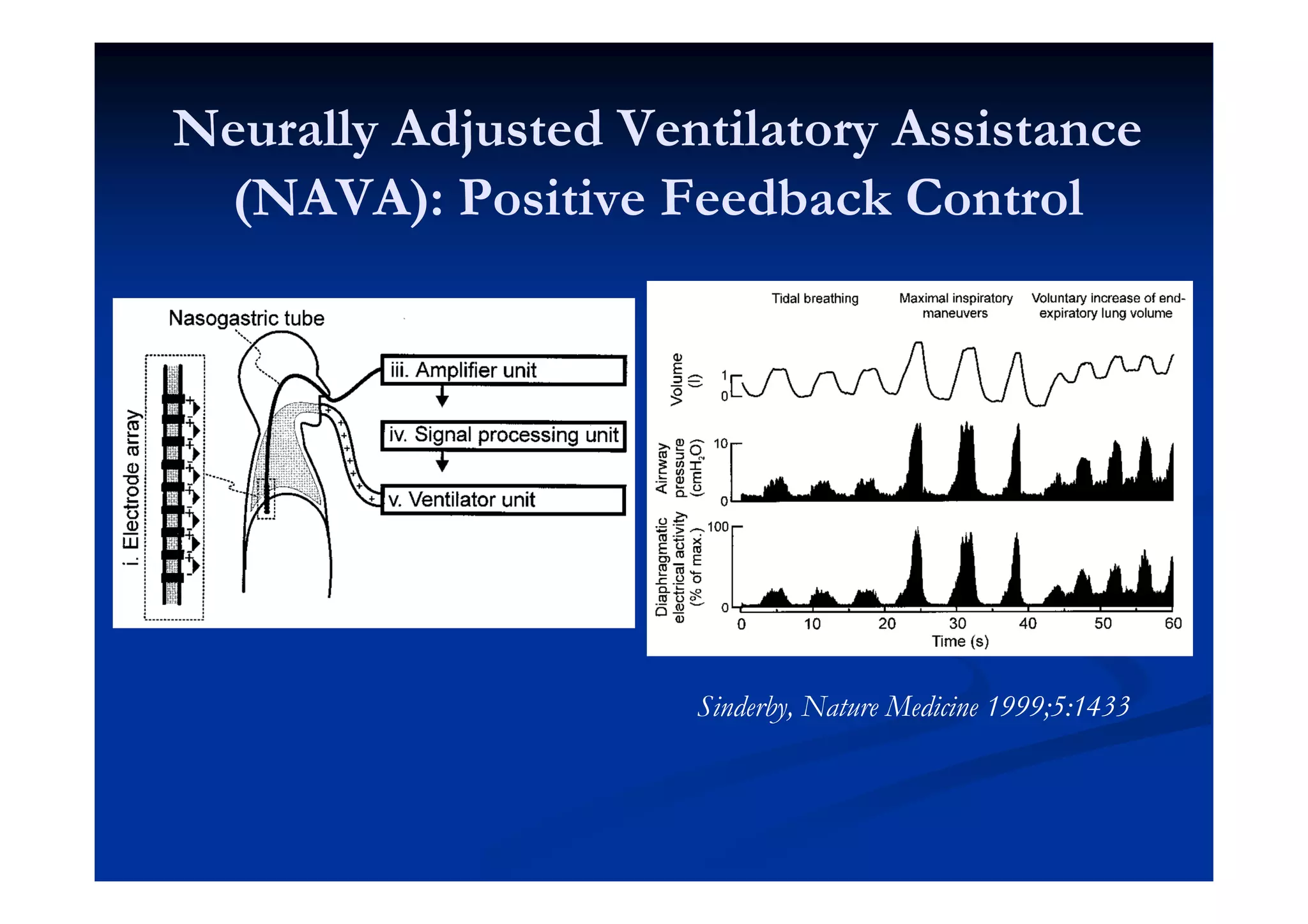 Neurally Adjusted Ventilatory Assistance
(NAVA): Positive Feedback Control

Sinderby, Nature Medicine 1999;5:1433

 