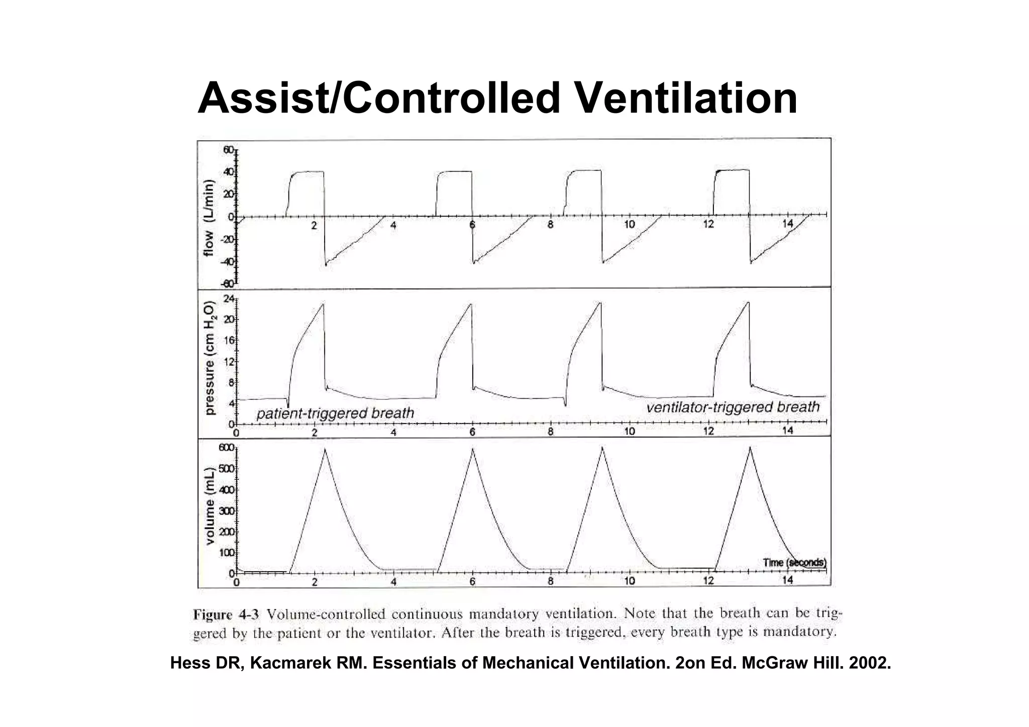 Assist/Controlled Ventilation

Hess DR, Kacmarek RM. Essentials of Mechanical Ventilation. 2on Ed. McGraw Hill. 2002.

 