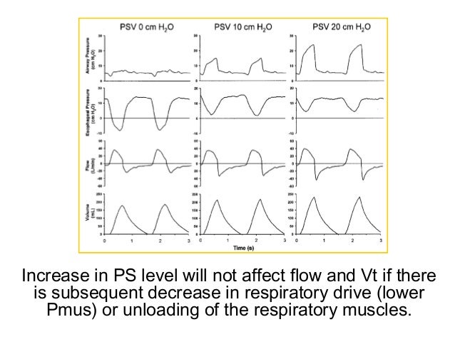 compression to ventilation ratio compression to ventilation ratio