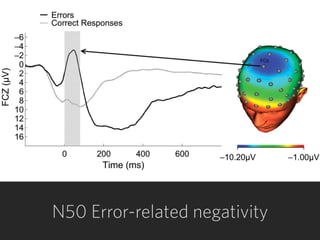 N50 Error-related negativity
 