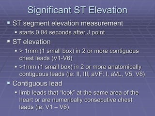 mod_i-12_lead_ekgs.ppt