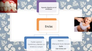Aparato digestivo en el
embarazo
Encías
Pueden aparecer
hiperémicas y blandas con
tendencia a sangrar
Aparece :
Inflamación focal o llamado
Epúlis
Este remite solo
 