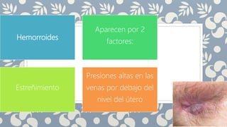 Hemorroides
Aparecen por 2
factores:
Estreñimiento
Presiones altas en las
venas por debajo del
nivel del útero
 