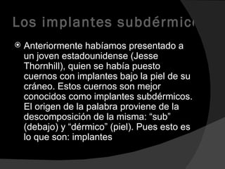Los implantes subdérmicos Anteriormente habíamos presentado a un joven estadounidense (Jesse Thornhill), quien se había puesto cuernos con implantes bajo la piel de su cráneo. Estos cuernos son mejor conocidos como implantes subdérmicos. El origen de la palabra proviene de la descomposición de la misma: “sub” (debajo) y “dérmico” (piel). Pues esto es lo que son: implantes  