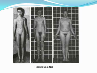Indivíduos XXY
 