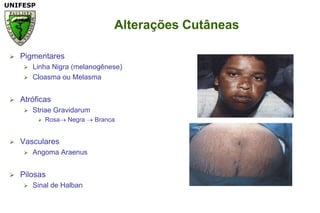 Alterações CutâneasPigmentaresLinhaNigra (melanogênese)CloasmaouMelasmaAtróficasStriaeGravidarumRosa Negra  BrancaVascularesAngomaAraenusPilosasSinal de Halban
