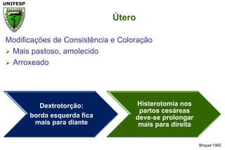 Briquet 1982ÚteroModificações de Consistência e ColoraçãoMais pastoso, amolecidoArroxeado