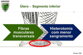 Briquet 1982Útero -  Segmento inferior		