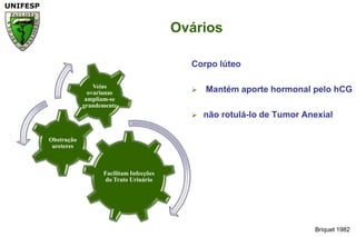 Briquet 1982OváriosCorpo lúteo Mantém aporte hormonal pelo hCGnão rotulá-lo de Tumor Anexial