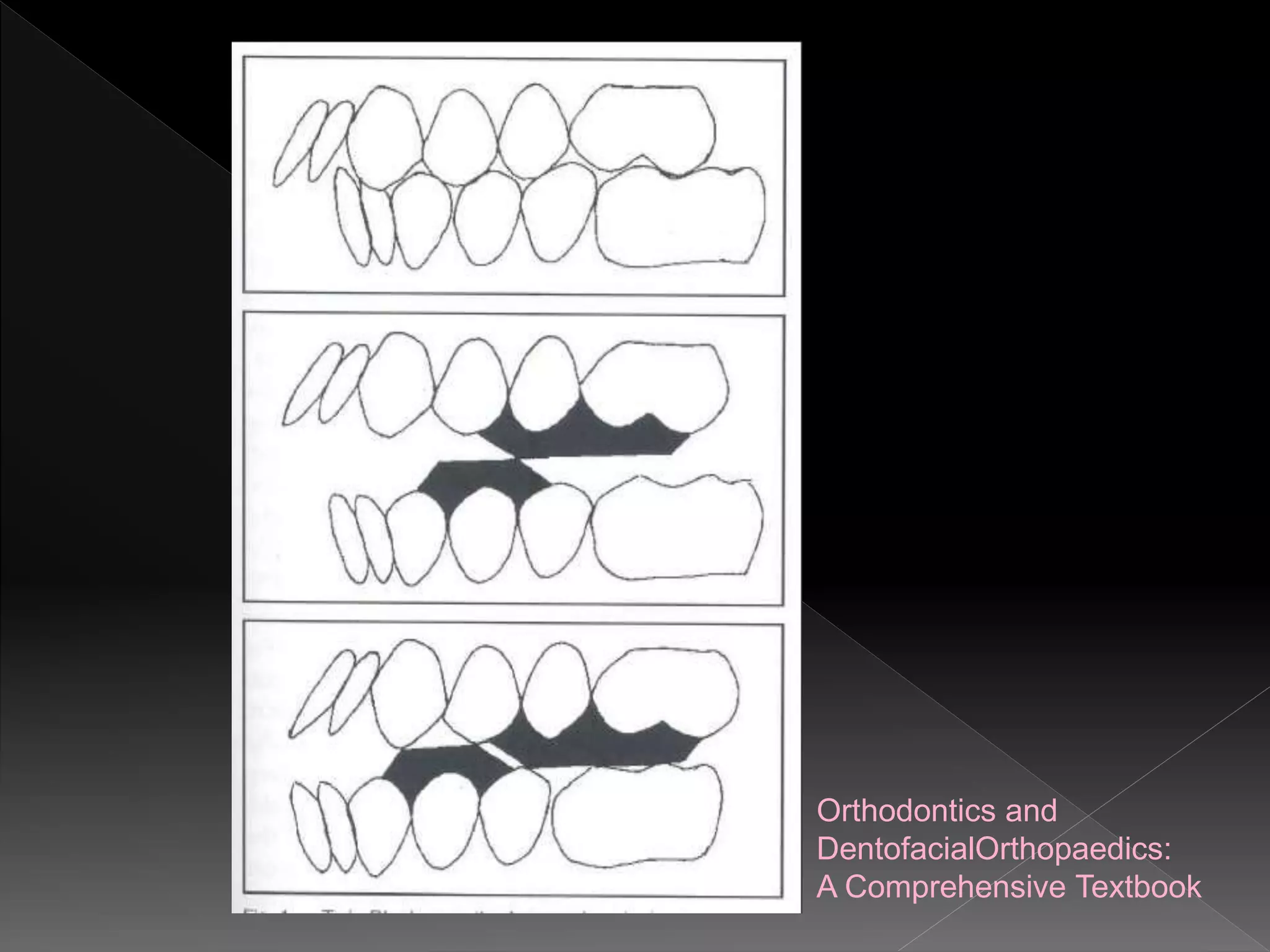 Orthodontics and
DentofacialOrthopaedics:
A Comprehensive Textbook
 