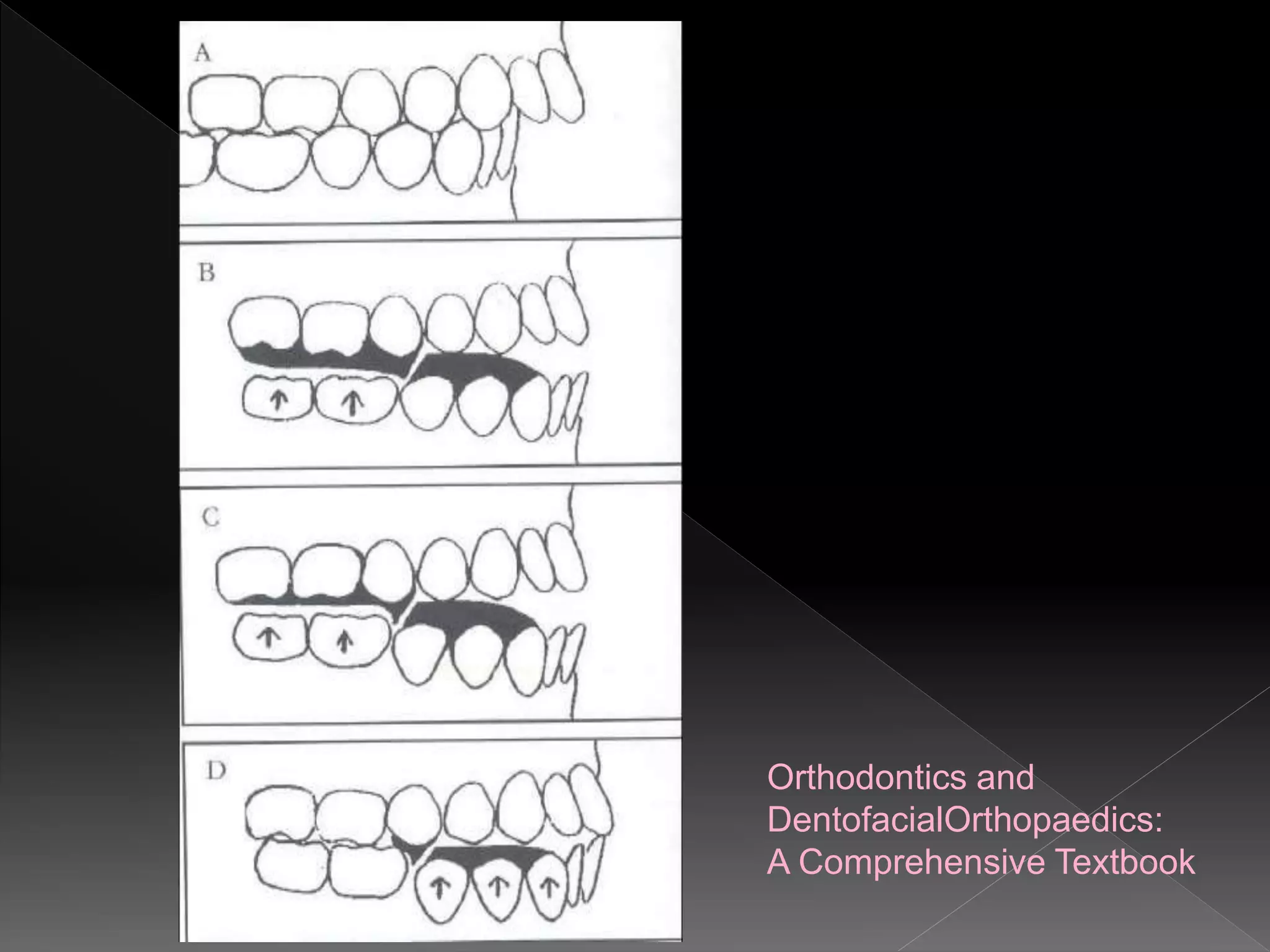 Orthodontics and
DentofacialOrthopaedics:
A Comprehensive Textbook
 