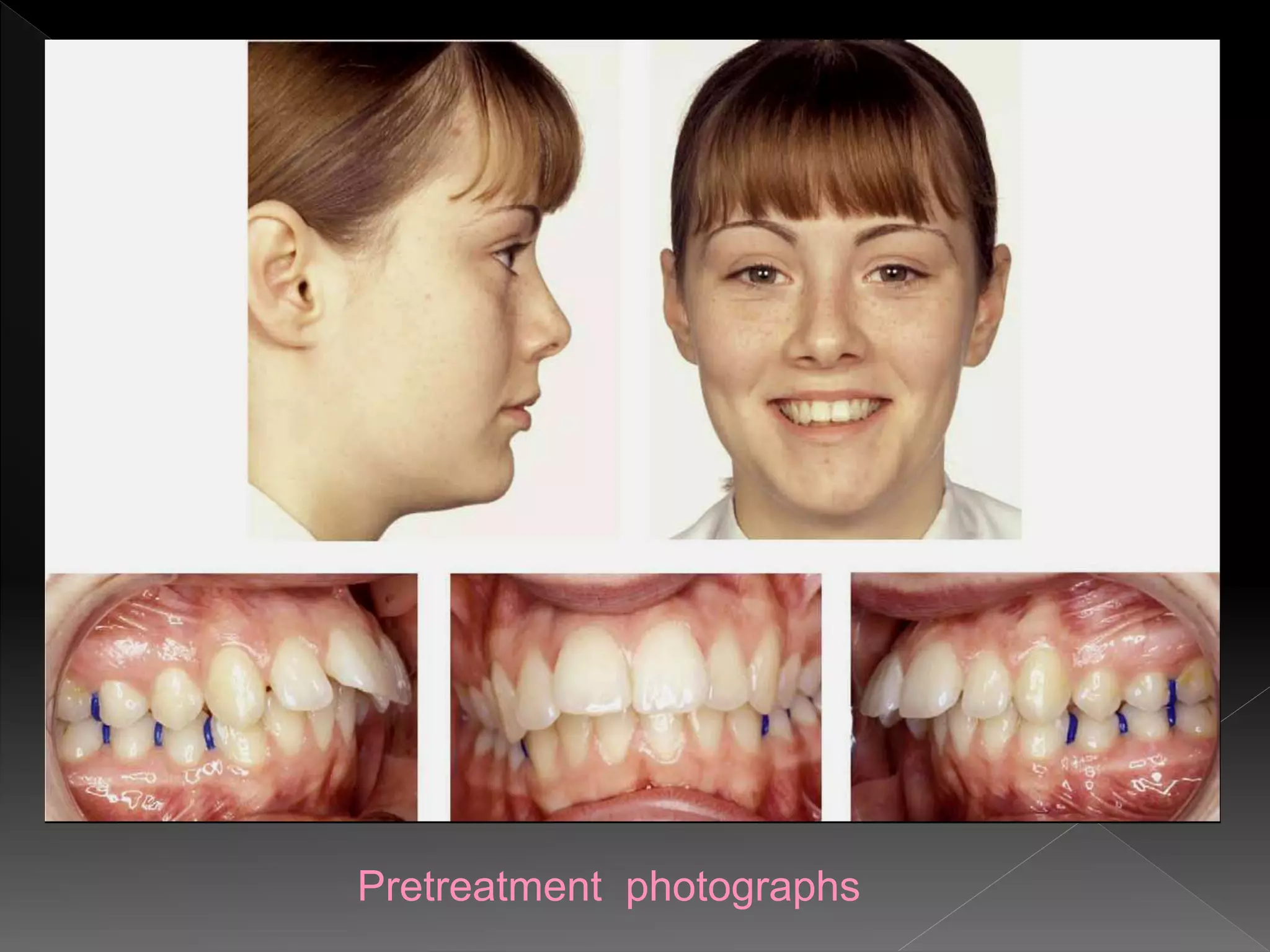 Pretreatment photographs
 