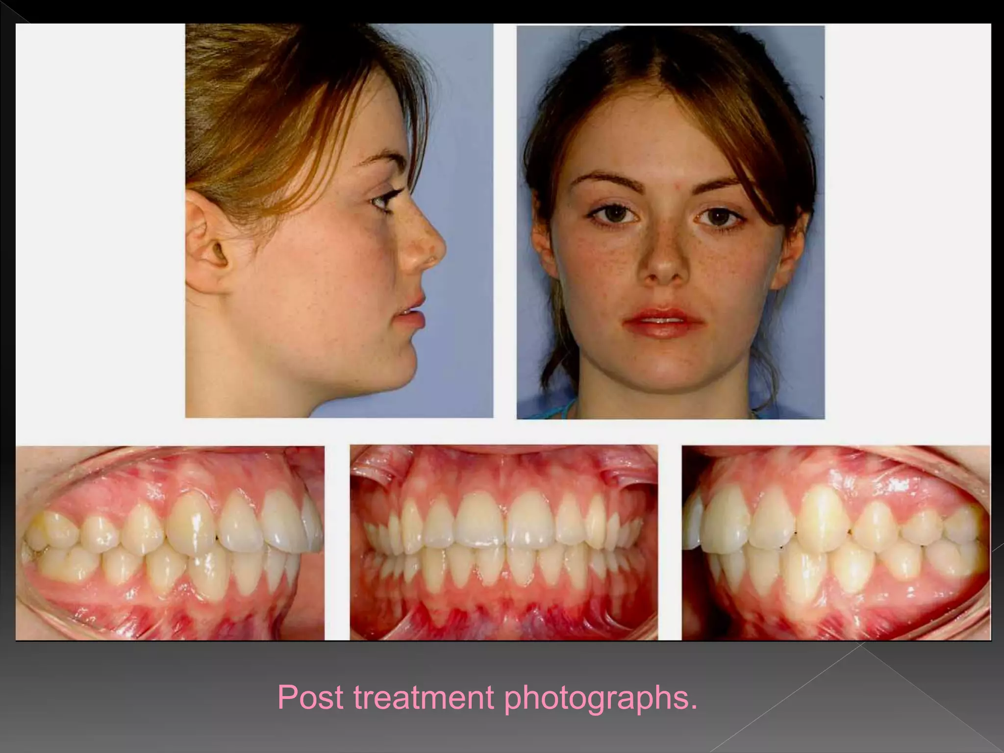 Post treatment photographs.
 