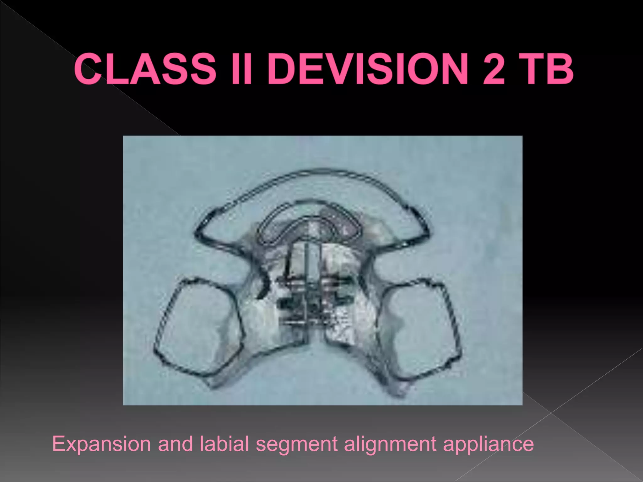 Expansion and labial segment alignment appliance
 