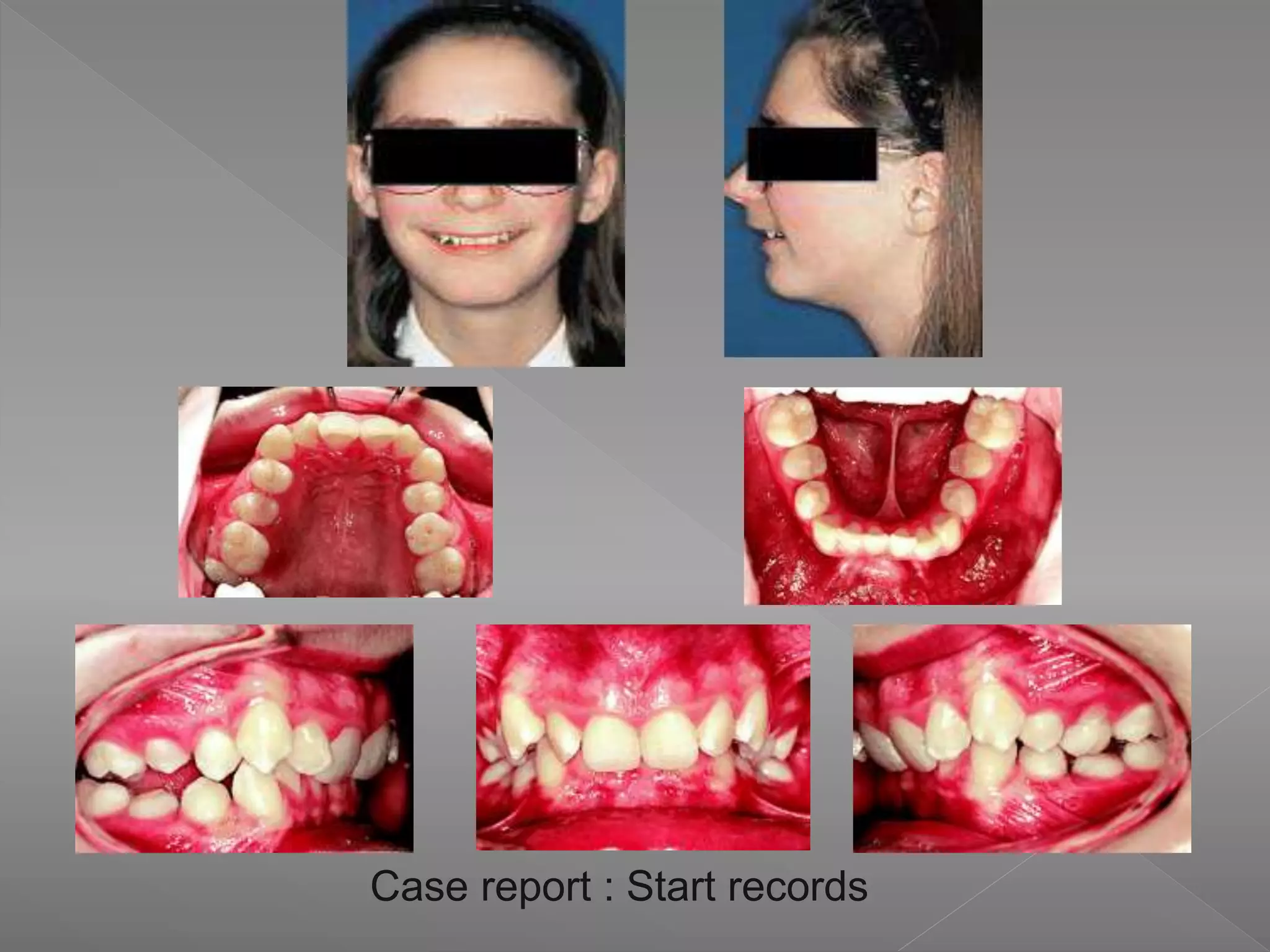 Case report : Start records
 