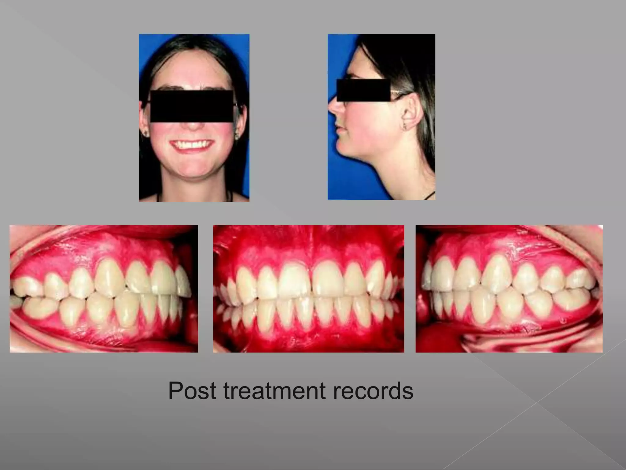 Post treatment records
 