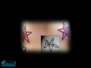 Modificazioni sessuali estreme
