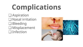 Ng Tube Injuries Comprehensive Guide to Nasogastric (NG) Tube Insertion and Removal ...
