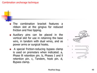 Modified begg orthodontics | PPT