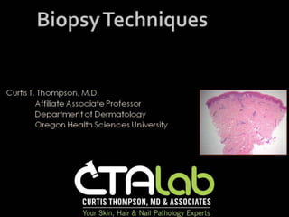 C. Thompson - Biopsy Techniques
