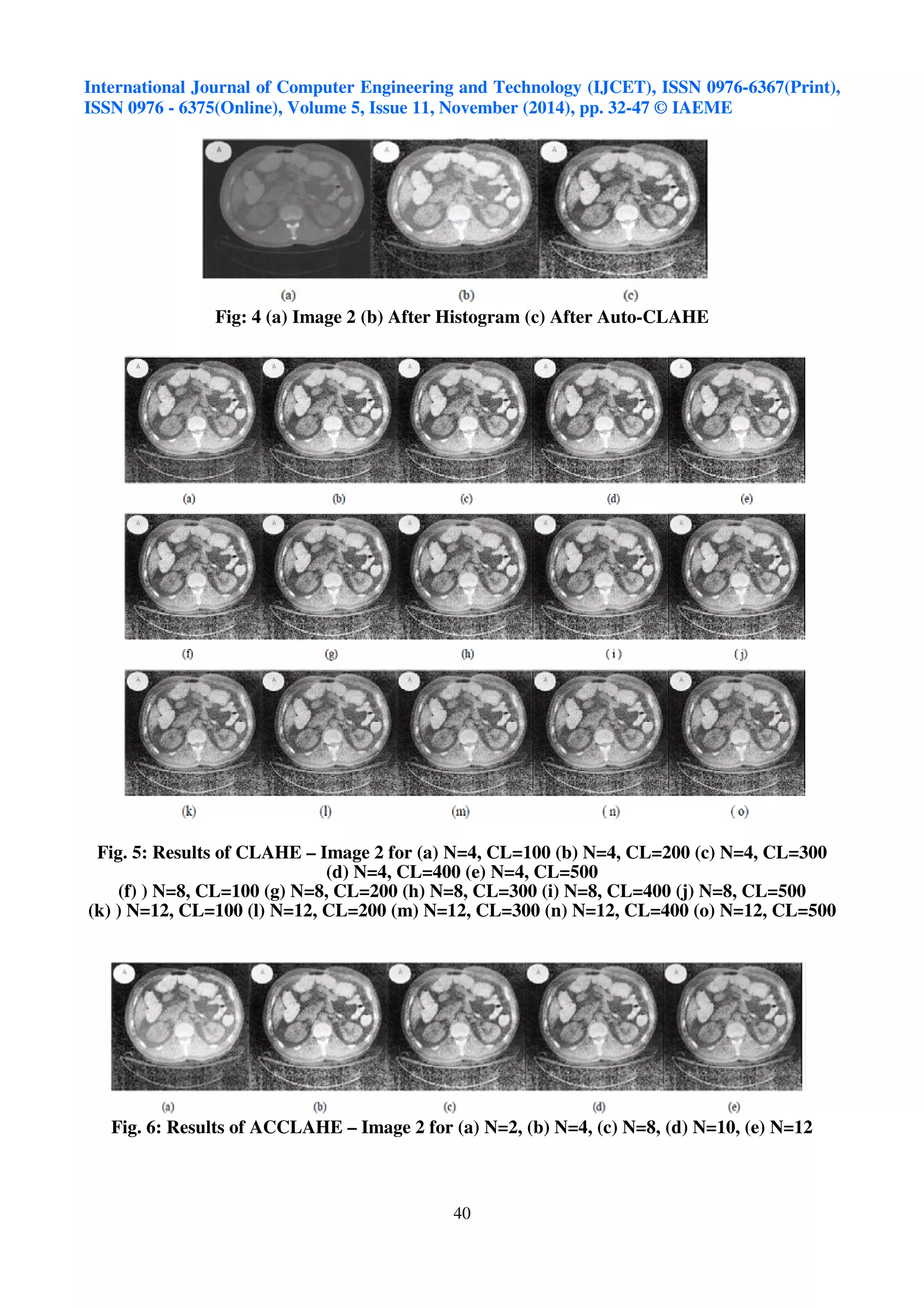 International Journal of Computer Engineering and Technology (IJCET), ISSN 0976-6367(Print), 
ISSN 0976 - 6375(Online), Volume 5, Issue 11, November (2014), pp. 32-47 © IAEME 
Fig: 4 (a) Image 2 (b) After Histogram (c) After Auto-CLAHE 
40 
 
Fig. 5: Results of CLAHE – Image 2 for (a) N=4, CL=100 (b) N=4, CL=200 (c) N=4, CL=300 
(d) N=4, CL=400 (e) N=4, CL=500 
(f) ) N=8, CL=100 (g) N=8, CL=200 (h) N=8, CL=300 (i) N=8, CL=400 (j) N=8, CL=500 
(k) ) N=12, CL=100 (l) N=12, CL=200 (m) N=12, CL=300 (n) N=12, CL=400 (o) N=12, CL=500 
Fig. 6: Results of ACCLAHE – Image 2 for (a) N=2, (b) N=4, (c) N=8, (d) N=10, (e) N=12 
 