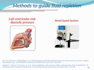49
Methods to guide fluid repletion
Left ventricular end-
diastolic pressure
Renal Guard System
Brar SS, Aharonian V, Mansukhani P, et al. Haemodynamic-guided fluid administration for the prevention of contrast- induced
acute kidney injury: the POSEIDON randomised controlled trial. Lancet 2014; 383:1814.
Briguori C, Visconti G, Focaccio A, et al. Renal Insufficiency After Contrast Media Administration Trial II (REMEDIAL II):
RenalGuard System in high-risk patients for contrast-induced acute kidney injury. Circulation 2011; 124:1260.
 